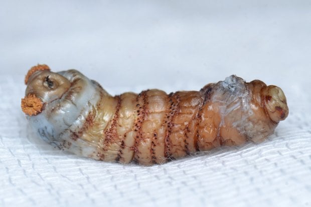 Man's horror as 20 live MAGGOTS are found living under his SKIN